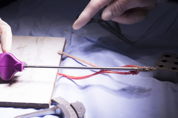 Knee tendon ligament surgery