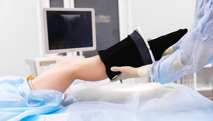 surgery of varicose veins. compression stockings