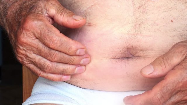 Old man touching his appendix