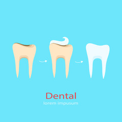 Dentistry. Vector illustration isolated on blue background.