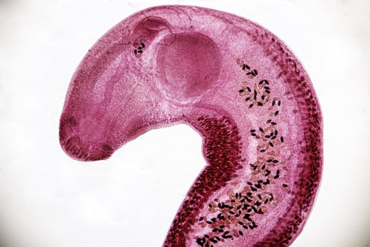 Echinostoma revolutum (parasite) under the microscope