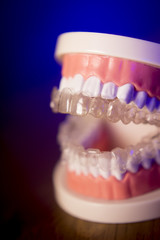 Denture with transparent orthodontics