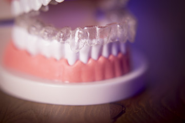 Denture with transparent orthodontics
