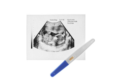 Ultrasound picture of baby and pregnancy test on white background