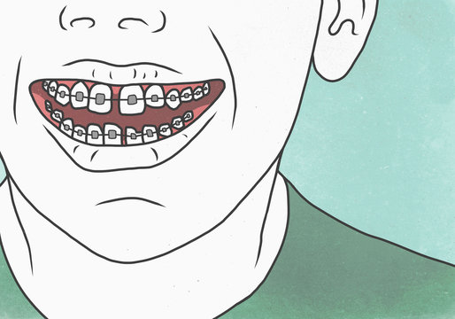 Illustration of man with braces representing dental health