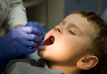 Five y.o. boy is under procedure to detect the plaque on his teeth - 130361910