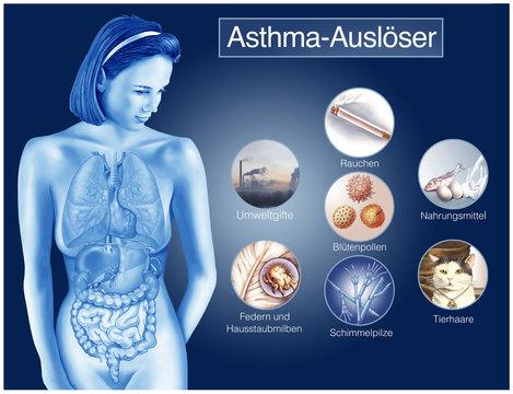 Asthma-Ausl&ouml;ser.Allergien.Bronchien
