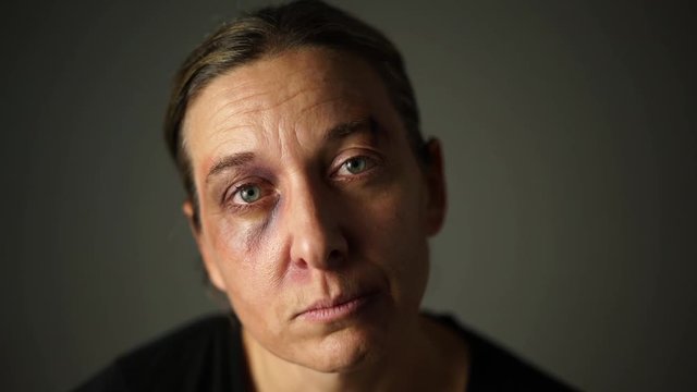 4k footage, sad face of battered woman with black eye from domestic violence looking in camera
