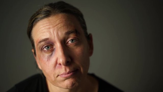4k footage, portrait of sad beaten woman with black eye and tears
