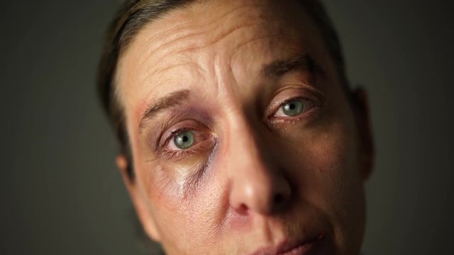 4k footage, closeup face of sad tortured woman with black eyes and tears looking in camera in despair
