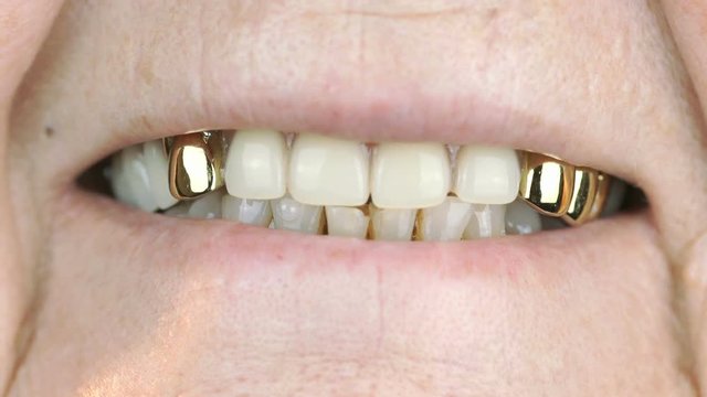 Adult woman with false teeth smiling at camera. Close up