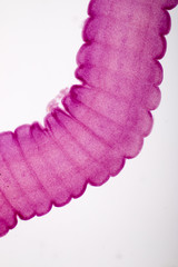 Senga Chiangmaiensis parasite on slide under microscope view.