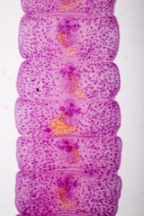 Senga Chiangmaiensis parasite on slide under microscope view.