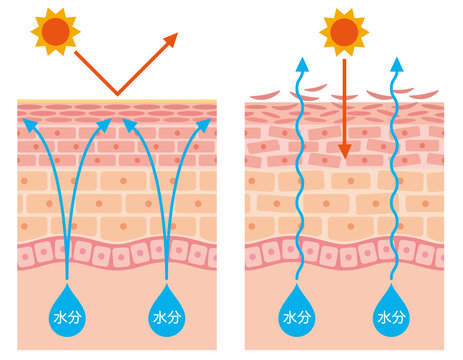 皮膚構造 乾燥肌 断面図 Stock イラスト Adobe Stock