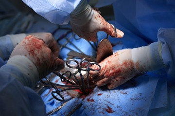 Surgery close-up with sticking up clamps and working hands of surgeons in bloody gloves