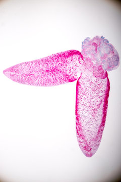 Diplozoon parasite under microscope view.