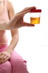 Kobieta trzyma pojemnik z próbką moczu 