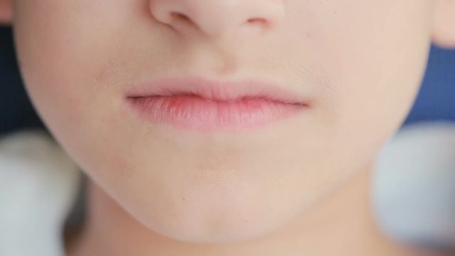 smiling child with braces on teeth