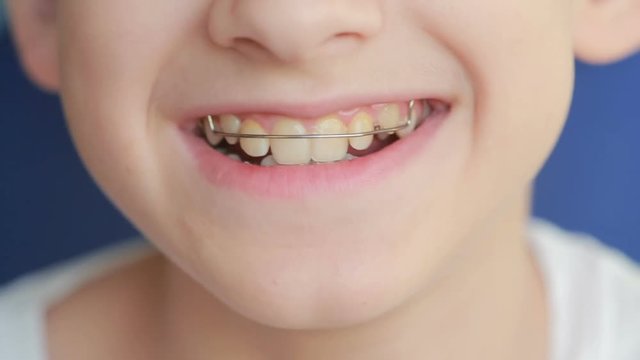 smiling child with braces on teeth