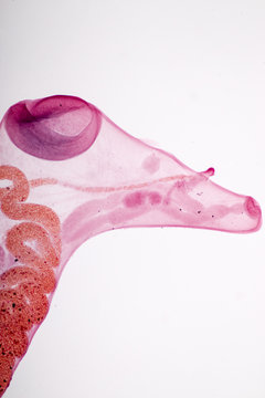 parasite on slide under microscope view.