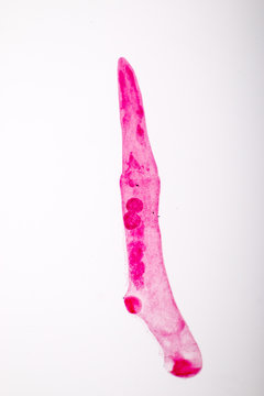 parasite on slide under microscope view.