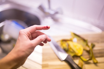 Ouch! Woman cut her finger while cooking a dinner in her kitchen.