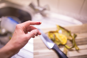 Ouch! Woman cut her finger while cooking a dinner in her kitchen.