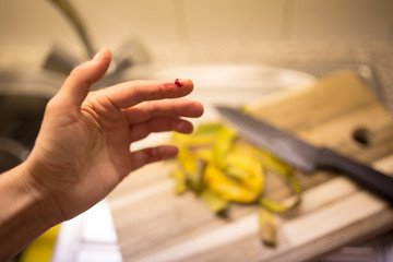 Ouch! Woman cut her finger while cooking a dinner in her kitchen.