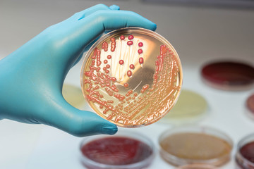 Escherichia coli colonies, Gram negative bacilli colonies as tes