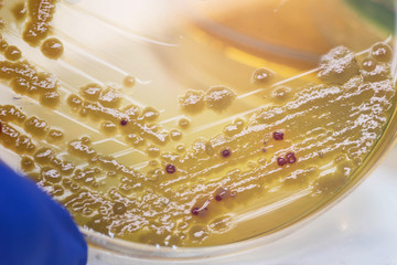 Gram negative bacilli colonies as test on MacConkey agar plate.