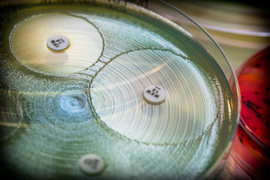 Meropenem and Imipenem sensitivity by diffusion method test.
