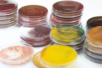 Bacterial colonies culture growth on selective media.