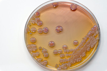 Klebsiella pneumoniae or Klebsiella spp.