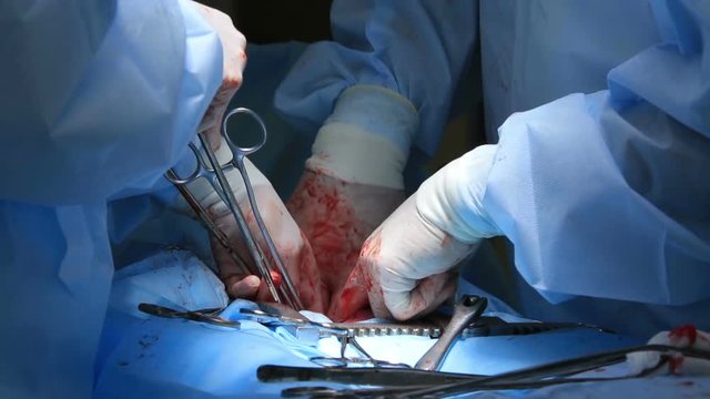 Surgery close-up with different surgical tools using by two surgeons (1080p, 25fps)