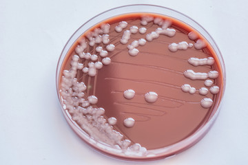 Colonies bacteria gram negative bacilli/ Gram negative cocco bac