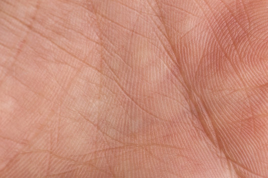 Macro photo of palm of the hand.
