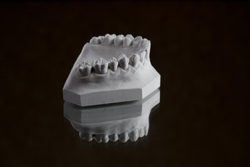 photograph of the lower jaw on a black background