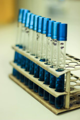 laboratory examination, laboratory testing, laboratory analysis, lab test, test tubes in racks