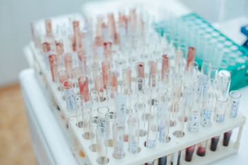 Мензурки с анализами крови в лаборатории.