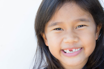 Asian girl smiling broken tooth