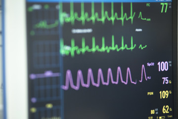 Electrocardiograph in hospital surgery