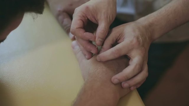 The doctor is looking for the acupuncture point with finger and injected needle into the patient's arm.