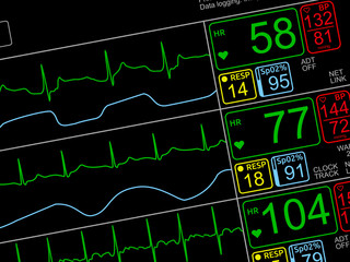 Patient's vital signs on ICU monitor, isolated closeup, dutched left