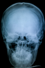 x-ray picture