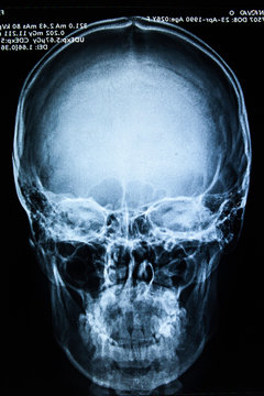 x-ray picture