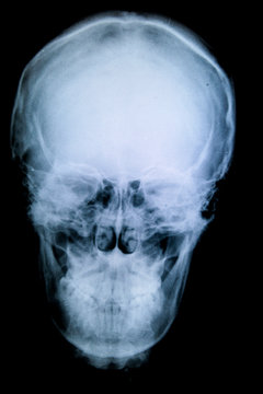 x-ray picture