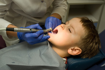 Five y.o. boy is under procedure of cleaning his teeth by the dentist - 131165526