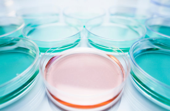 Coloured solutions in petri dish