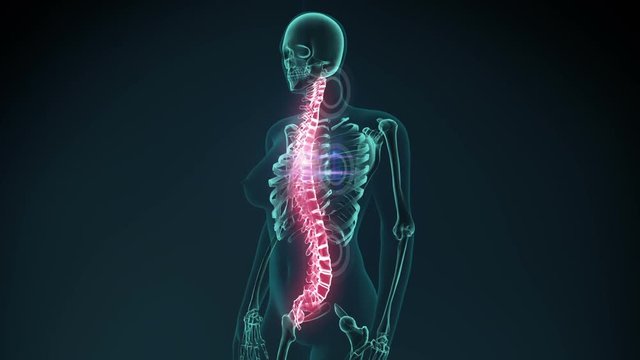 3d rendered illustration of a painful Vertebra. medical concept animation.