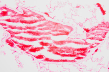 Blood Cessels Injected